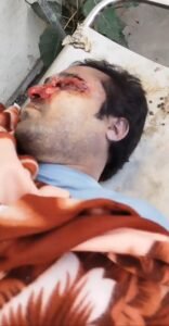 हरिद्वार: जिला अस्पताल की मोर्चरी में चूहे ने कुतरा शव, परिजनों का हंगामा